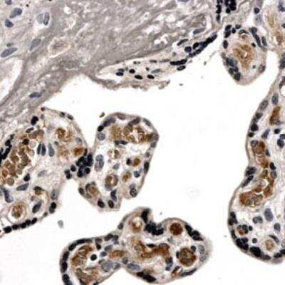 Immunohistochemistry-Paraffin: TIMP1 Antibody (MM0034-4A16) [NB110-61000] - Formalin fixed and paraffin embedded normal human placenta tissue is subjected to mouse anti human TIMP-1