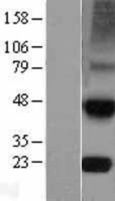 Western Blot: TIMP4 Overexpression Lysate (Adult Normal) [NBL1-16927] - Western Blot experiments.  Left-Control; Right -Over-expression Lysate for TIMP4