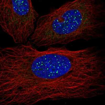 Immunocytochemistry/Immunofluorescence: TIN2 Antibody [NBP2-56834] - Staining of human cell line U-2 OS shows localization to nuclear bodies. Antibody staining is shown in green.