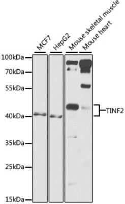 Western Blot: TIN2 Antibody [NBP2-95205] - Analysis of extracts of various cell lines, using TIN2 at 1:1000 dilution. Secondary antibody: HRP Goat Anti-Rabbit IgG (H+L) at 1:10000 dilution. Lysates/proteins: 25ug per lane. Blocking buffer: 3% nonfat dry milk in TBST. Detection: ECL Basic Kit . Exposure time: 90s.