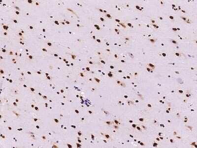 Immunohistochemistry-Paraffin: TINP1 Antibody [NBP2-99405] - Immunochemical staining TINP1 in human brain with rabbit polyclonal antibody at 1:2000 dilution, formalin-fixed paraffin embedded sections.