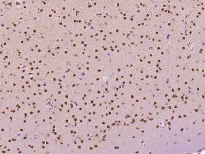 Immunohistochemistry-Paraffin: TINP1 Antibody [NBP2-99405] - Immunochemical staining TINP1 in mouse brain with rabbit polyclonal antibody at 1:300 dilution, formalin-fixed paraffin embedded sections.