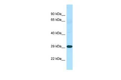 Western Blot: TINP1 Antibody [NBP2-85920] - WB Suggested Anti-NSA2 Antibody. Titration: 1.0 ug/ml. Positive Control: Fetal Heart