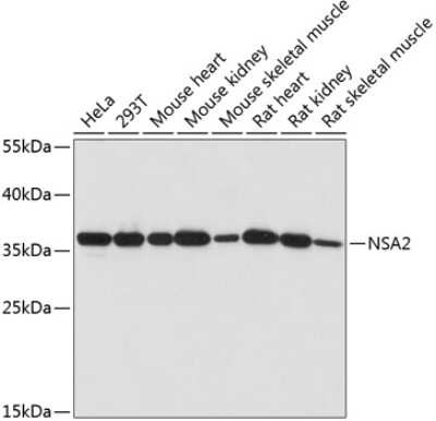 Western Blot: TINP1 Antibody [NBP2-94402] - Analysis of extracts of various cell lines, using TINP1 at 1:1000 dilution.Secondary antibody: HRP Goat Anti-Rabbit IgG (H+L) at 1:10000 dilution.Lysates/proteins: 25ug per lane.Blocking buffer: 3% nonfat dry milk in TBST.Detection: ECL Basic Kit .Exposure time: 60s.
