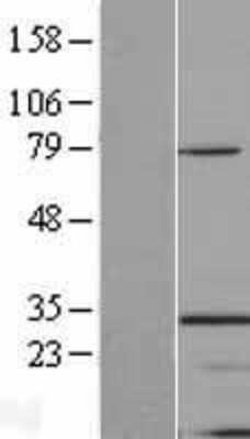 Western Blot: TINP1 Overexpression Lysate (Adult Normal) [NBL1-16931] Left-Empty vector transfected control cell lysate (HEK293 cell lysate); Right -Over-expression Lysate for TINP1.