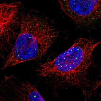 Immunocytochemistry/ Immunofluorescence TIP120B Antibody - BSA Free