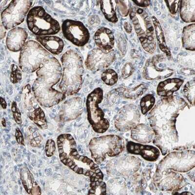 Immunohistochemistry-Paraffin: TIP120B Antibody [NBP2-33858] - Staining of human kidney shows strong cytoplasmic and membranous positivity in cells in tubules.