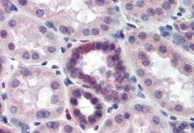 Immunohistochemistry-Paraffin: TIP120B Antibody [NBP1-03166] - Staining of human kidney tissue after heat-induced antigen retrieval. Antibody dilution 1:500.