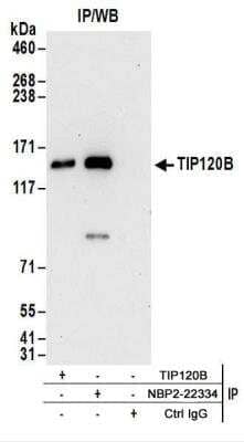 <b>Biological Strategies Validation. </b>Immunoprecipitation: TIP120B Antibody [NBP2-22334] - Samples:  Whole cell lysate (1 mg for IP; 20% of IP loaded) from 293T cells.  Antibodies:  NBP2-22334 used for IP at 6 ug/mg lysate.  TIP120B was also immunoprecipitated by rabbit anti-TIP120B antibody.  For blotting immunoprecipitated TIP120B, NBP2-22334 was used at 0.2 ug/ml.  Detection: Chemiluminescence with an exposure time of 30 seconds.