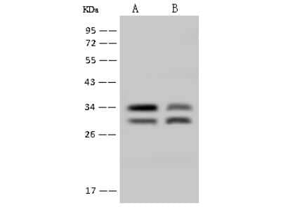 Immunohistochemistry: TIP30 Antibody [NBP2-98510] - Anti-TIP30 rabbit polyclonal antibody at 1:500 dilution. Lane A: A549 Whole Cell Lysate Lane B: SW480 Whole Cell Lysate Lysates/proteins at 30 ug per lane. Secondary Goat Anti-Rabbit IgG (H+L)/HRP at 1/10000 dilution. Developed using the ECL technique. Performed under reducing conditions. Predicted band size: 27 kDa