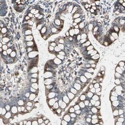 Immunohistochemistry-Paraffin: TIP30 Antibody [NBP1-88170] - Staining of human small intestine shows moderate to strong cytoplasmic positivity in glandular cells.