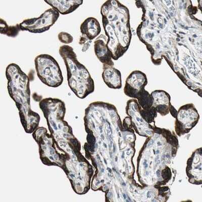 Immunohistochemistry-Paraffin: TIP30 Antibody [NBP1-88170] - Staining of human placenta shows moderate to strong cytoplasmic positivity in trophoblastic cells.