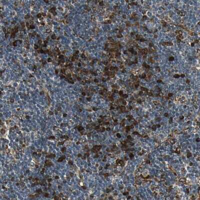 Immunohistochemistry-Paraffin: TIP30 Antibody [NBP1-88170] - Staining of human lymph node shows moderate cytoplasmic positivity.
