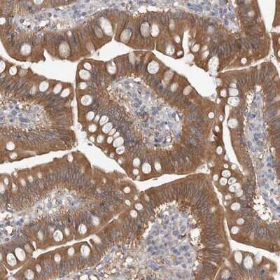 Immunohistochemistry-Paraffin TIP30 Antibody - BSA Free