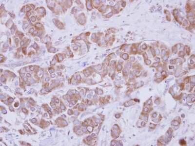 Immunohistochemistry-Paraffin TIP30 Antibody