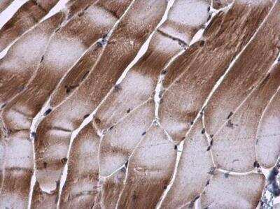 Immunohistochemistry-Paraffin TIP30 Antibody