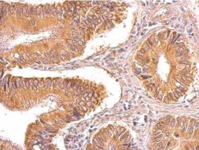 Immunohistochemistry-Paraffin TIP30 Antibody