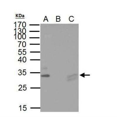 Immunoprecipitation TIP30 Antibody