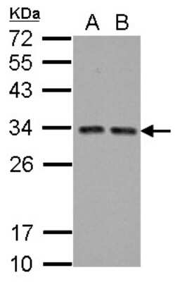 Western Blot TIP30 Antibody