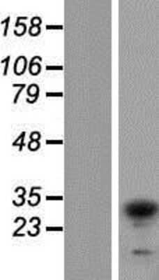 Western Blot TIP30 Overexpression Lysate