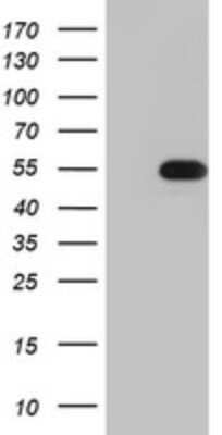 Western Blot: TIPIN Antibody (OTI2E6) - Azide and BSA Free [NBP2-74528] - Analysis of HEK293T cells were transfected with the pCMV6-ENTRY control (Left lane) or pCMV6-ENTRY TIPIN.