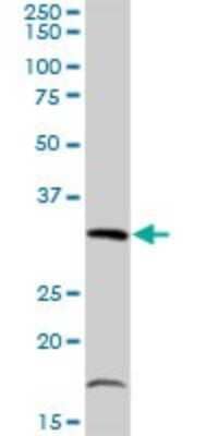 Western Blot: TIPIN Antibody [H00054962-D01P] - Analysis of TIPIN expression in human kidney.