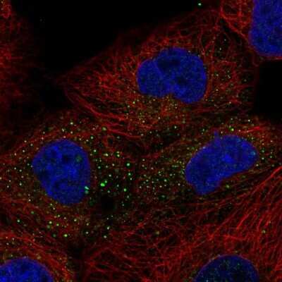 Immunocytochemistry/Immunofluorescence: TIPRL Antibody [NBP1-85169] - Immunofluorescent staining of human cell line A-431 shows localization to vesicles.