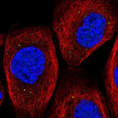 Immunocytochemistry/Immunofluorescence: TIPRL Antibody [NBP2-55024] - Staining of human cell line A-431 shows localization to vesicles.