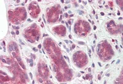 Immunohistochemistry-Paraffin: TIPRL Antibody [NBP1-51995] - 3.75ug/ml staining of paraffin embedded Human Breast. Steamed antigen retrieval with citrate buffer pH 6, AP-staining.