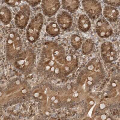 Immunohistochemistry-Paraffin: TIPRL Antibody [NBP1-85169] - Staining of human duodenum shows strong nuclear and cytoplasmic positivity in glandular cells.