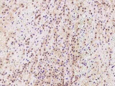 Immunohistochemistry-Paraffin: TIPRL Antibody [NBP2-98503] - Immunochemical staining of human TIPRL in human adrenal gland with rabbit polyclonal antibody at 1:500 dilution, formalin-fixed paraffin embedded sections.