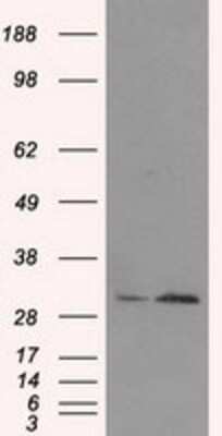 Western Blot: TIPRL Antibody (OTI3D11) - Azide and BSA Free [NBP2-74529] - HEK293T cells were transfected with the pCMV6-ENTRY control (Left lane) or pCMV6-ENTRY TIPRL (Right lane) cDNA for 48 hrs and lysed. Equivalent amounts of cell lysates (5 ug per lane) were separated by SDS-PAGE and immunoblotted with anti-TIPRL.