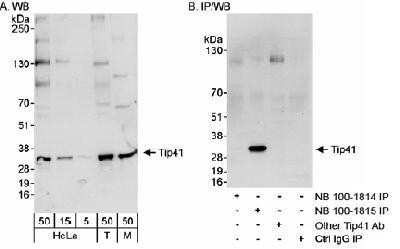 Western Blot: TIPRL Antibody [NB100-1814] - Detection of Human and Mouse Tip41 on HeLa whole cell lysate using NB100-1814. Tip41 was successfully immunoprecipitated by rabbit anti-Tip41 antibody NB100-1815.