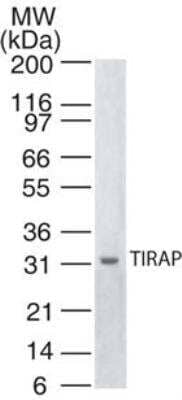 Western Blot: TIRAP Antibody (20D1055.1) [NB100-56730] - Analysis of TIRAP in human spleen lysate using this antibody.