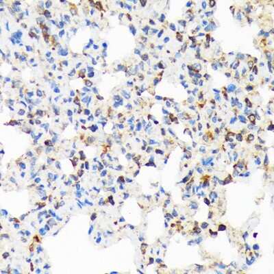 Immunohistochemistry-Paraffin: TIRAP Antibody (9T1A8) [NBP3-16854] - Immunohistochemistry of paraffin-embedded rat lung using TIRAP Rabbit mAb (NBP3-16854) at dilution of 1:100 (40x lens).Perform microwave antigen retrieval with 10 mM Tris/EDTA buffer pH 9.0 before commencing with IHC staining protocol.