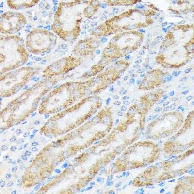 Immunohistochemistry-Paraffin: TIRAP Antibody (9T1A8) [NBP3-16854] - Immunohistochemistry of paraffin-embedded mouse kidney using TIRAP Rabbit mAb (NBP3-16854) at dilution of 1:100 (40x lens).Perform microwave antigen retrieval with 10 mM Tris/EDTA buffer pH 9.0 before commencing with IHC staining protocol.