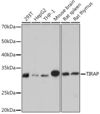 Western Blot: TIRAP Antibody (9T1A8) [NBP3-16854] - Western blot analysis of extracts of various cell lines, using TIRAP Rabbit mAb (NBP3-16854) at 1:1000 dilution. Secondary antibody: HRP Goat Anti-Rabbit IgG (H+L) at 1:10000 dilution. Lysates/proteins: 25ug per lane. Blocking buffer: 3% nonfat dry milk in TBST. Detection: ECL Basic Kit. Exposure time: 10s.