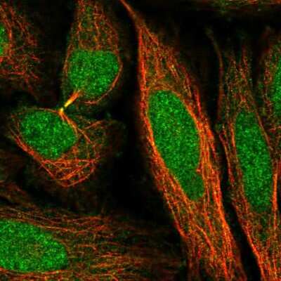 Immunocytochemistry/Immunofluorescence: TIRAP Antibody [NBP2-47605] - Immunofluorescent staining of human cell line SiHa shows localization to nucleoplasm, cytosol & cytokinetic bridge.