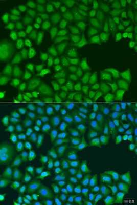 Immunocytochemistry/Immunofluorescence: TIRAP Antibody [NBP2-95138] - Analysis of U2OS cells using TIRAP at dilution of 1:100. Blue: DAPI for nuclear staining.