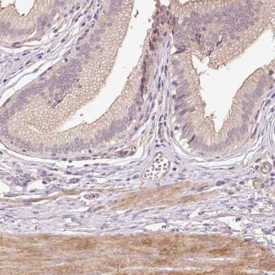 Immunohistochemistry-Paraffin: TIRAP Antibody [NBP2-47605] - Staining of human gallbladder shows cytoplasmic and membranous positivity in glandular cells.