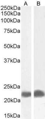 Western Blot: TIRAP Antibody [NB100-2823] - Staining (0.3µg/ml) of A549 (A) and K562 (B) cell lysate (35µg protein in RIPA buffer). Detected by chemiluminescence.