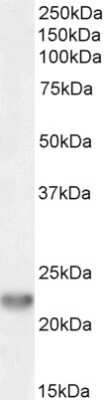 Western Blot: TIRAP Antibody [NB100-2823] - Staining (0.3ug/ml) of Human colorectal cancer lysate (35ug protein in RIPA buffer). Detected by chemiluminescence.