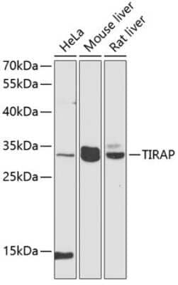 Western Blot: TIRAP Antibody [NBP2-95138] - Analysis of extracts of various cell lines, using TIRAP at 1:1000 dilution. Secondary antibody: HRP Goat Anti-Rabbit IgG (H+L) at 1:10000 dilution. Lysates/proteins: 25ug per lane. Blocking buffer: 3% nonfat dry milk in TBST. Detection: ECL Basic Kit . Exposure time: 90s.