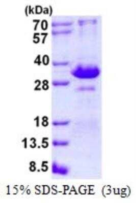 SDS-Page: Recombinant Human TIRAP (TLR2 and TLR4) Protein [NBP2-22871] - 