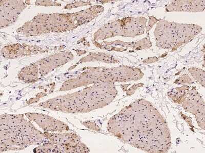 Immunohistochemistry-Paraffin: TIS11D Antibody [NBP2-97954] - Immunochemical staining of human TIS11D in human smooth muscle with rabbit polyclonal antibody at 1:100 dilution, formalin-fixed paraffin embedded sections.