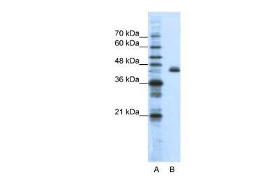 Western Blot: TIS11D Antibody [NBP2-83655] - WB Suggested Anti-ZFP36L2 Antibody Titration: 1.25ug/ml. Positive Control: HepG2 cell lysateZFP36L2 is strongly supported by BioGPS gene expression data to be expressed in Human HepG2 cells