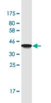 Western Blot: TJAP1 Antibody (2E5) [H00093643-M01-100ug] - Detection against immunogen (37.18 kDa).