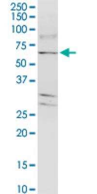 Western Blot: TJAP1 Antibody (2E5) [H00093643-M01-100ug] - TJAP1 monoclonal antibody (M01), clone 2E5. Western Blot analysis of TJAP1 expression in Hela S3 NE.