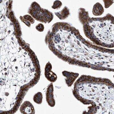 Immunohistochemistry-Paraffin: TJAP1 Antibody [NBP1-80902] - Staining of human placenta shows strong cytoplasmic positivity with a granular pattern in trophoblastic cells.