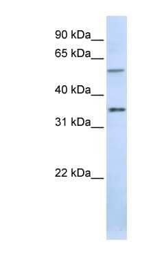 Western Blot: TJAP1 Antibody [NBP1-53200] - Titration: 0.2-1 ug/ml, Positive Control: Human Placenta.